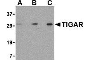 Western Blotting (WB) image for anti-TP53 induced glycolysis regulatory phosphatase (TIGAR) (Middle Region 1) antibody (ABIN1031193)