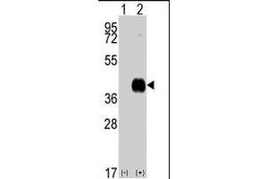 Western blot analysis of CAMK1 (arrow) using CAMK1 polyclonal antibody . (CAMK1 Antikörper  (C-Term))