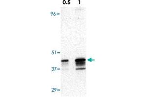 Western blot analysis of RRM2B expression in A-431 cell lysate with RRM2B polyclonal antibody  at 0. (RRM2B Antikörper  (AA 2-17))