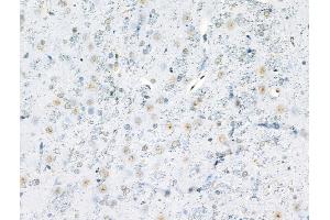 anti-Myogenic Differentiation 1 (MYOD1) (pSer200) antibody
