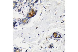 Immunohistochemistry of paraffin-embedded human breast using Mammaglobin A Rabbit mAb (ABIN7270186) at dilution of 1:100 (40x lens). (Mammaglobin A Antikörper)