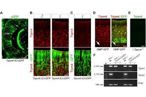 Double labeling of Trpm4 (red) and τGFP (green). (Esel anti-Kaninchen IgG (Heavy & Light Chain) Antikörper)