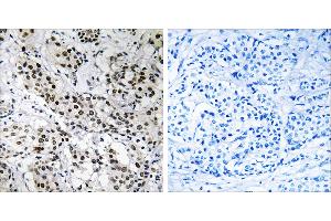 Peptide - + (APBB2 Antikörper)