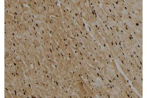 ABIN6274012 at 1/100 staining Rat heart tissue by IHC-P.