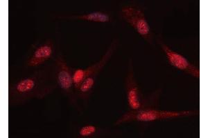 IF analysis of PGK1 using anti-PGK1 antibody (ABIN3043604).