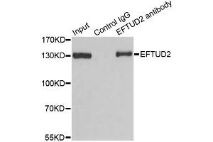 Immunoprecipitation analysis of 100ug extracts of 293T cells using 3ug EFTUD2 antibody. (EFTUD2 Antikörper)