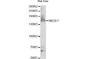 Western blot analysis of extracts of rat liver, using ABCB11 antibody (ABIN6291730) at 1:1000 dilution. (ABCB11 Antikörper)