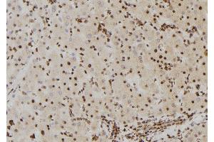 ABIN6267382 at 1/100 staining Human liver tissue by IHC-P. (BRAF Antikörper  (pSer446))