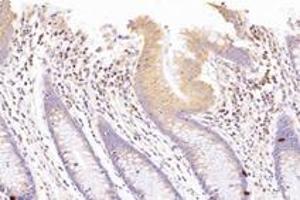 Immunohistochemistry analysis of paraffin-embedded human colon using,SUV3L1 (ABIN7075769) at dilution of 1: 1500 (SUPV3L1 Antikörper)