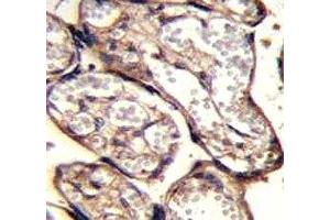 Immunohistochemistry (IHC) image for anti-Insulin-Like Growth Factor 2 (IGF2) (AA 39-68) antibody (ABIN3031346)