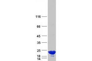 Western Blotting (WB) image for Crystallin, alpha A (CRYAA) protein (Myc-DYKDDDDK Tag) (ABIN2714620)