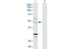 Western Blot analysis of ZNF277 expression in transfected 293T cell line by ZNF277 MaxPab polyclonal antibody. (ZNF277 Antikörper  (AA 1-438))