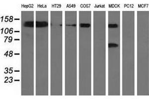 Western blot analysis of extracts (35 µg) from 9 different cell lines by using anti-L1CAM monoclonal antibody. (L1CAM Antikörper)