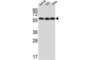 Western Blotting (WB) image for anti-UTP6, Small Subunit (SSU) Processome Component, Homolog (UTP6) antibody (ABIN3002297) (UTP6 Antikörper)