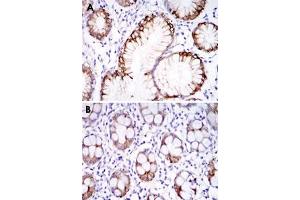 Immunohistochemical analysis of paraffin-embedded human stomach tissues (A) and colon tissues (B) using CA9 monoclonal antibody, clone 2D3  with DAB staining. (CA9 Antikörper)