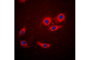 Immunofluorescent analysis of 4EBP1 staining in MCF7 cells. (eIF4EBP1 Antikörper  (N-Term))