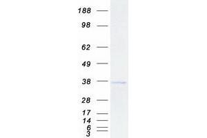 Validation with Western Blot