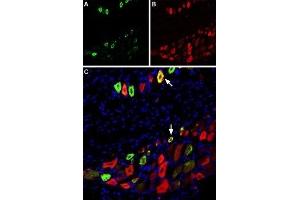 Immunohistochemistry (IHC) image for anti-Sodium Channel, Voltage-Gated, Type X, alpha Subunit (SCN10A) (AA 1943-1956), (Intracellular) antibody (Atto 594) (ABIN7043654)