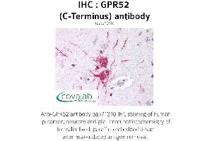 Image no. 1 for anti-G Protein-Coupled Receptor 52 (GPR52) (C-Term), (Cytoplasmic Domain) antibody (ABIN1735119) (GPR52 Antikörper  (C-Term, Cytoplasmic Domain))