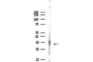 anti-Kv Channel Interacting Protein 3, Calsenilin (KCNIP3) (pSer63) antibody
