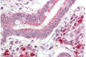Rabbit Anti-NSMCE4A Antibody Catalog Number: ARP70964 Formalin Fixed Paraffin Embedded Tissue: Human Adult Small intestine  Observed Staining: Cytoplasm in hepatocytes Primary Antibody Concentration: 1:600 Secondary Antibody: Donkey anti-Rabbit-Cy3 Secondary Antibody Concentration: 1:200 Magnification: 20X Exposure Time: 0. (NSMCE4A Antikörper  (C-Term))