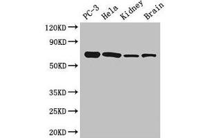 Western Blot Positive WB detected in: PC-3 whole cell lysate, Hela whole cell lysate, Mouse kidney tissue, Mouse brain tissue All lanes: GPI antibody at 2. (GPI Antikörper  (AA 2-554))
