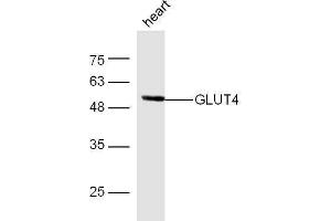 Western Blotting (WB) image for anti-Solute Carrier Family 2 (Facilitated Glucose Transporter), Member 4 (SLC2A4) (AA 401-509) antibody (ABIN739445)