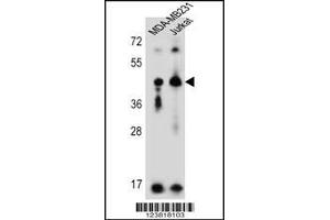 Western Blotting (WB) image for anti-Killer Cell Immunoglobulin-Like Receptor, Two Domains, Long Cytoplasmic Tail, 2 (KIR2DL2) (AA 263-291), (C-Term) antibody (ABIN5533883)