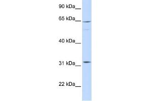 ARHGAP25 antibody used at 1 ug/ml to detect target protein. (ARHGAP25 Antikörper  (Middle Region))