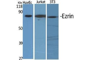 Western Blotting (WB) image for anti-Ezrin (EZR) (C-Term) antibody (ABIN3184571)