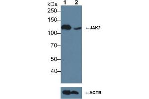 Knockout Varification: ;Lane 1: Wild-type Jurkat cell lysate; ;Lane 2: JAK2 knockout Jurkat cell lysate; ;Predicted MW: 130kDa ;Observed MW: 130kDa;Primary Ab: 3µg/ml Rabbit Anti-Human JAK2 Antibody;Second Ab: 0. (JAK2 Antikörper  (AA 508-800))