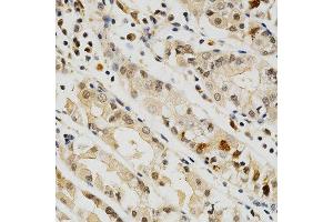 Immunohistochemistry of paraffin-embedded human stomach using CD274 antibody at dilution of 1:200 (x400 lens) (PD-L1 Antikörper)