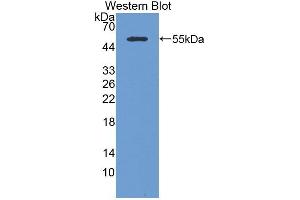 Detection of Recombinant CK14, Mouse using Polyclonal Antibody to Cytokeratin 14 (CK14) (KRT14 Antikörper  (AA 1-484))