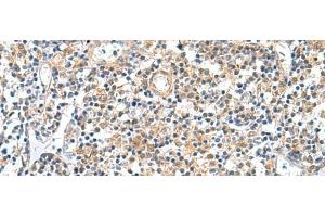 Immunohistochemistry of paraffin-embedded Human tonsil tissue using GEMIN7 Polyclonal Antibody at dilution of 1:50(x200) (GEMIN7 Antikörper)