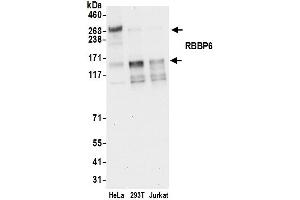 anti-Retinoblastoma Binding Protein 6 (RBBP6) (AA 50-100) antibody
