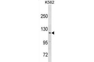 Western Blotting (WB) image for anti-Hect Domain and RLD 3 (HERC3) antibody (ABIN3000995) (HERC3 Antikörper)