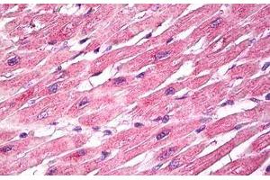 Anti-EPM2A / Laforin antibody IHC staining of human heart.