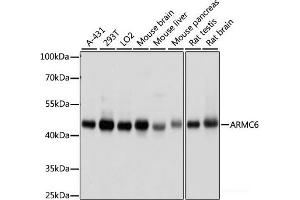 Western blot analysis of extracts of various cell lines using ARMC6 Polyclonal Antibody at dilution of 1:1000. (ARMC6 Antikörper)