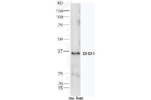Mouse liver lysates probed with Rabbit Anti-DHDH Polyclonal Antibody, Unconjugated (ABIN2559590) at 1:300 overnight at 4˚C. (DHDH Antikörper  (AA 281-334))