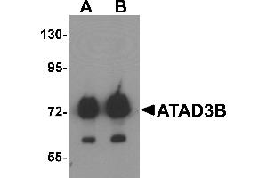 Western blot analysis of ATAD3B in human kidney tissue lysate with ATAD3B antibody at (A) 1 and (B) 2 µg/mL .