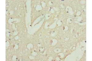 Immunohistochemistry of paraffin-embedded human brain tissue using ABIN7146436 at dilution of 1:100 (CAMK1D Antikörper  (AA 1-180))