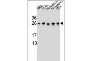 RAB3D Antibody (C-term) (ABIN657140 and ABIN2846278) western blot analysis in K562,HL-60,MDA-M,MDA-M,CEM cell line lysates (35 μg/lane). (RAB3D Antikörper  (C-Term))