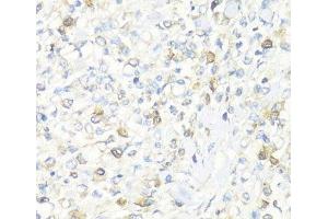 Immunohistochemistry (Paraffin-embedded Sections) (IHC (p)) image for anti-Eukaryotic Translation Initiation Factor 3 Subunit J (EIF3S1) antibody (ABIN7264670)