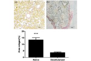 Immunohistochemistry (IHC) image for anti-Collagen, Type I (COL1) antibody (ABIN5596819)