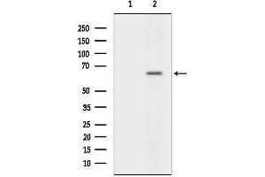 Western blot analysis of lysates from HepG2 cells(heat-shock treatment), using KCNV2 Antibody.