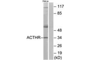 Western blot analysis of extracts from HeLa cells, using ACTHR Antibody.