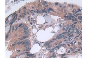 Immunohistochemistry (IHC) image for anti-Matrix Metallopeptidase 23B (MMP23B) (AA 79-390) antibody (ABIN7431308)