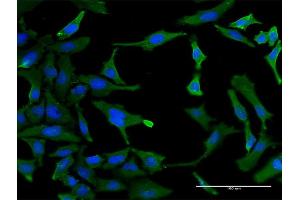 Immunofluorescence (IF) image for anti-Splicing Factor 3b, Subunit 2, 145kDa (SF3B2) (AA 1-636) antibody (ABIN524388)