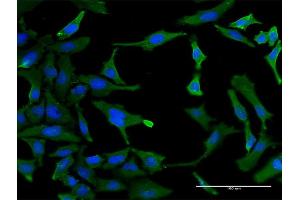 Immunofluorescence of monoclonal antibody to SF3B2 on HeLa cell. (SF3B2 Antikörper  (AA 1-636))