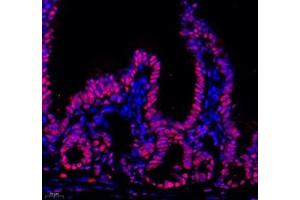 Immunofluorescent analysis of paraformaldehyde-fixed mouse ileum using HNRNPM (ABIN7074247) at dilution of 1: 4000 (HnRNP M1-M4 Antikörper)